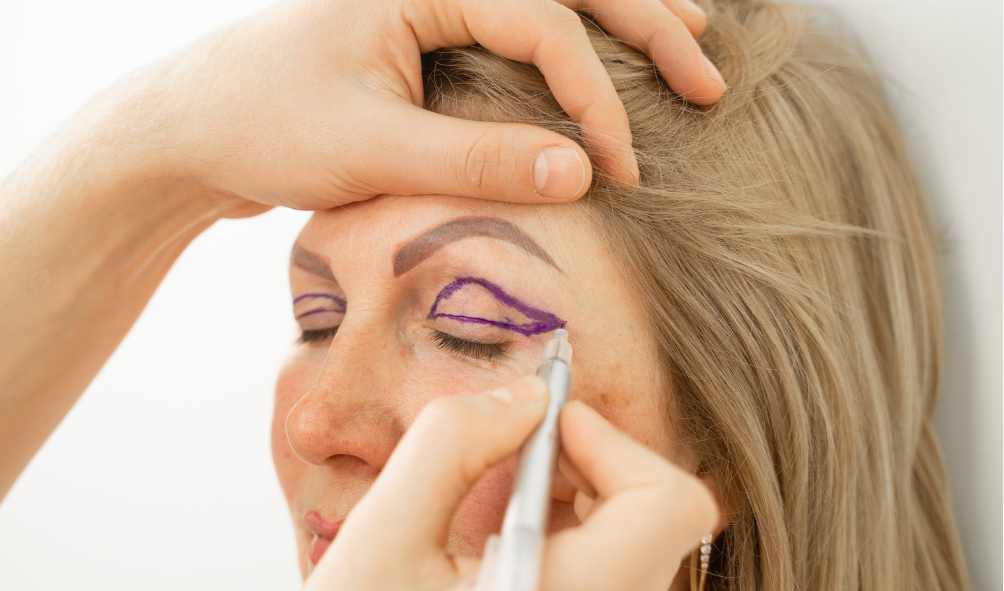 Eyelid Surgery in Kolkata